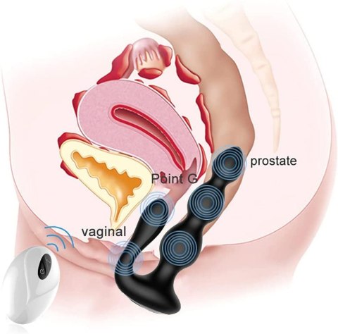 RemoteSilicone AnalBeads